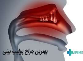 دکتر خوب برای عمل پولیپ بینی در تهران