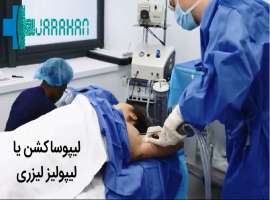 عمل لیپوساکشن با لیزر عمل لیپوساکشن با لیزر