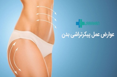 عوارض عمل پیکرتراشی | خطرات روش های مختلف پیکرتراشی بدن