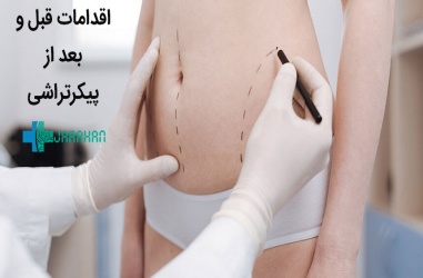 اقدامات و مراقبت های قبل و بعد از عمل پیکرتراشی