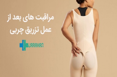 مراقبت ها و اقدامات بعد از عمل تزریق چربی و تاثیر آن در نتیجه عمل