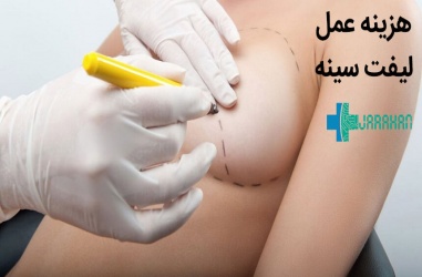 هزینه لیفت سینه یا جراحی بالا کشیدن سینه ها