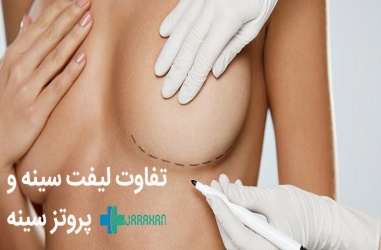 تفاوت عمل پروتز سینه و لیفت سینه، کدام روش برای من مناسب تر است؟