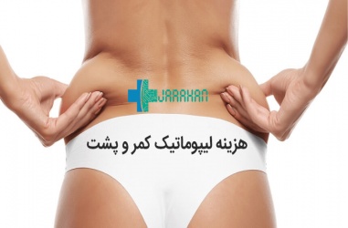 هزینه عمل لیپوماتیک پشت و کمر در تهران