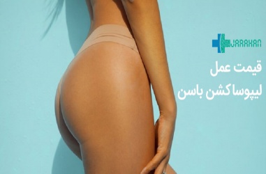 هزینه عمل لیپوساکشن باسن در سال 99 چقدراست؟