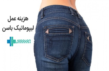 هزینه عمل لیپوماتیک باسن در تهران چقدر است؟