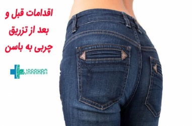اقداماتی که قبل و بعد از تزریق چربی به باسن باید انجام شود