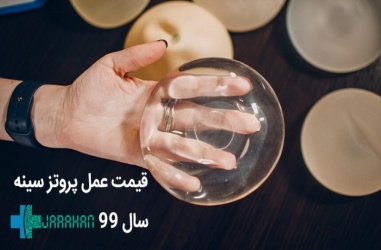 قیمت خرید و هزینه عمل پروتز سینه در سال 1400