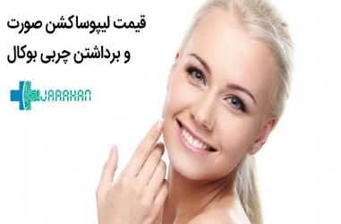 هزینه عمل لیپوساکشن صورت و بوکال در تهران سال 99
