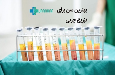 بهترین سن برای عمل تزریق چربی کدام است؟
