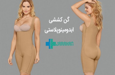 گن عمل ابدومینوپلاستی چیست و چه مزایایی دارد؟