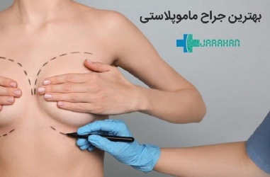 چگونه می توان بهترین جراح را برای عمل ماموپلاستی انتخاب کرد؟