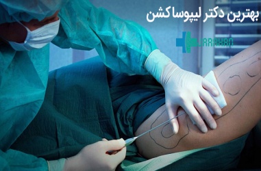 بهترین جراح لیپوساکشن در تهران و کشور