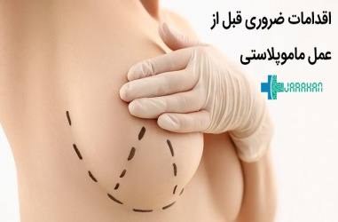 اقداماتی که قبل از عمل ماموپلاستی باید حتما انجام شود
