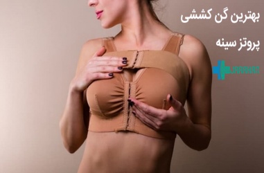 بهترین گن کششی برای عمل پروتز سینه کدام نوع است؟