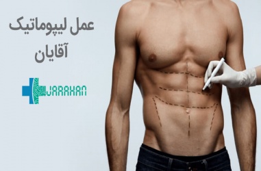 کاربرد گسترده عمل لیپوماتیک برای تناسب اندام آقایان