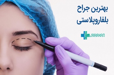 نمونه عمل های بهترین جراح بلفاروپلاستی چه ویژگی هایی دارد؟