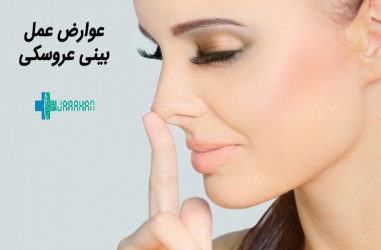 عوارض عمل بینی عروسکی