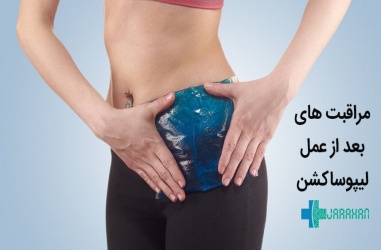 مراقبت های بعد از لیپوساکشن