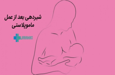 شیردهی بعد از ماموپلاستی یا عمل جراحی زیبایی سینه