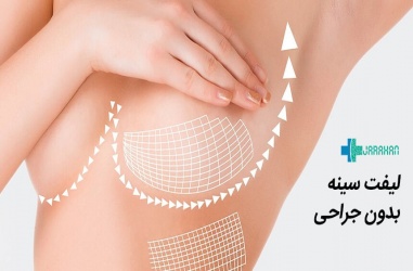 لیفت سینه بدون جراحی چیست و چه روشهایی دارد؟