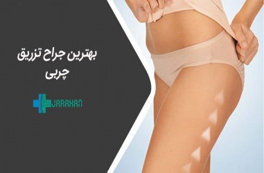 بهترین دکتر جراح تزریق چربی در تهران چه ویژگی هایی دارد؟