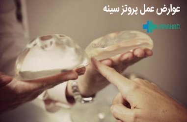 عوارض جراحی پروتز سینه و راه کارهای جلوگیری از آن