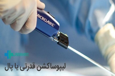 لیپوساکشن قدرتی یا پال چیست و چه مزایایی دارد؟