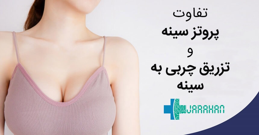 مقایسه عمل پروتز سینه با تزریق چربی به سینه