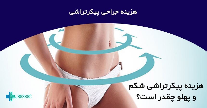 هزینه عمل پیکرتراشی شکم و پهلو در تهران