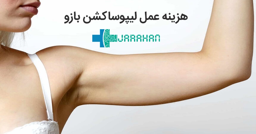 هزینه عمل لیپوساکشن بازوها در تهران سال 99 و 1400