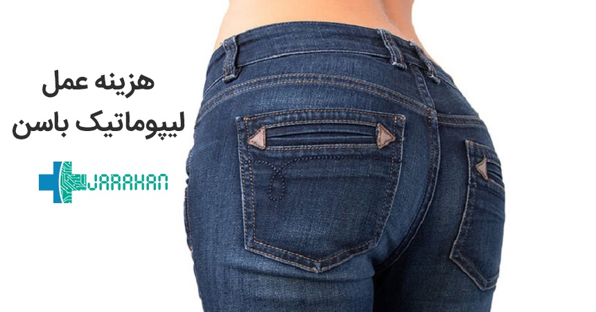 هزینه عمل لیپوماتیک باسن در تهران چقدر است؟