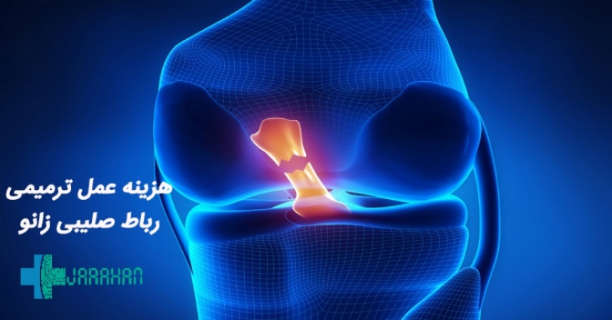 قیمت عمل پارگی رباط صلیبی زانو با بیمه های مختلف در سال 1400 چقدر است؟