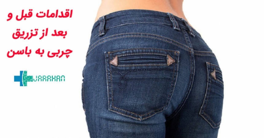 اقداماتی که قبل و بعد از تزریق چربی به باسن باید انجام شود
