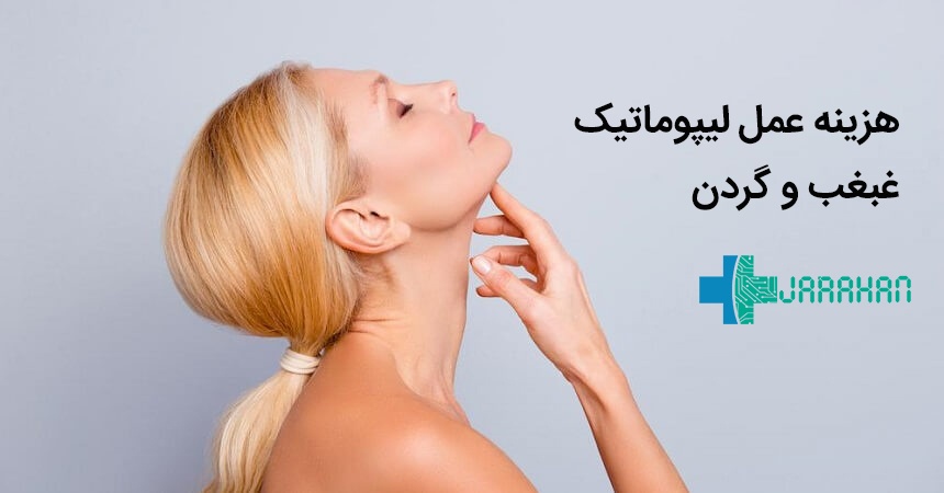 هزینه عمل لیپوماتیک غبغب و گردن در سال 1400 تهران