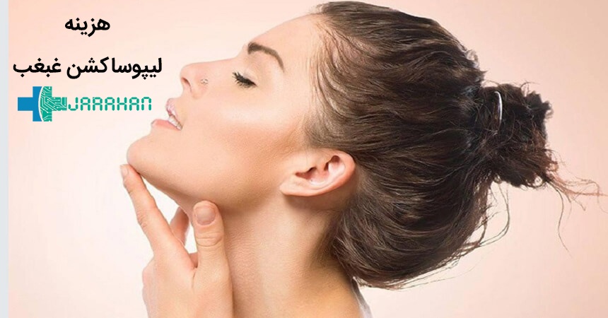 هزینه جراحی لیپوساکشن غبغب و گردن در سال 1400 تهران