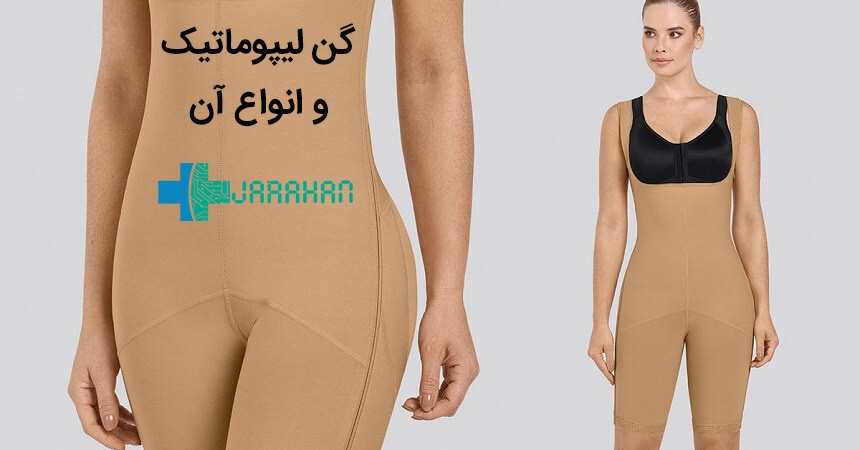 گن لیپوماتیک چیست و چه انواعی دارد؟