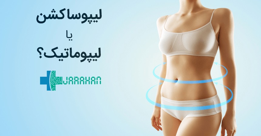 مقایسه دو روش لیپوساکشن و لیپوماتیک