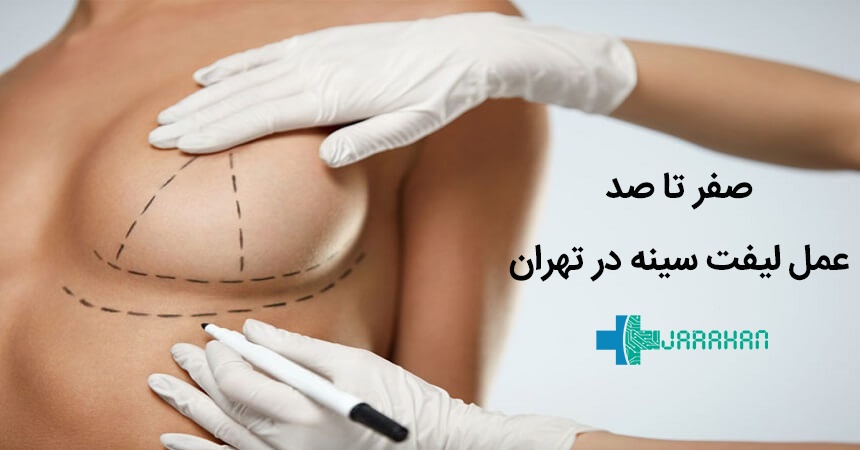 صفر تا صد عمل لیفت سینه یا ماستوپکسی در تهران
