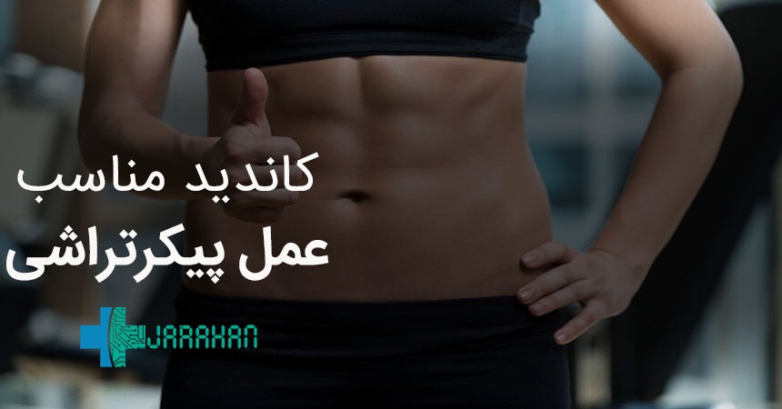 پیکر تراشی برای چه افرادی مناسب است؟ بهترین کاندید پیکرتراشی کیست؟