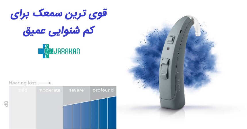 قویترین و بهترین سمعک برای کم شنوایی شدید تا عمیق چیست؟