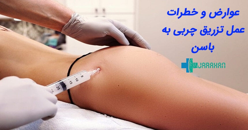 عمل تزریق چربی به باسن چه عوارضی دارد؟