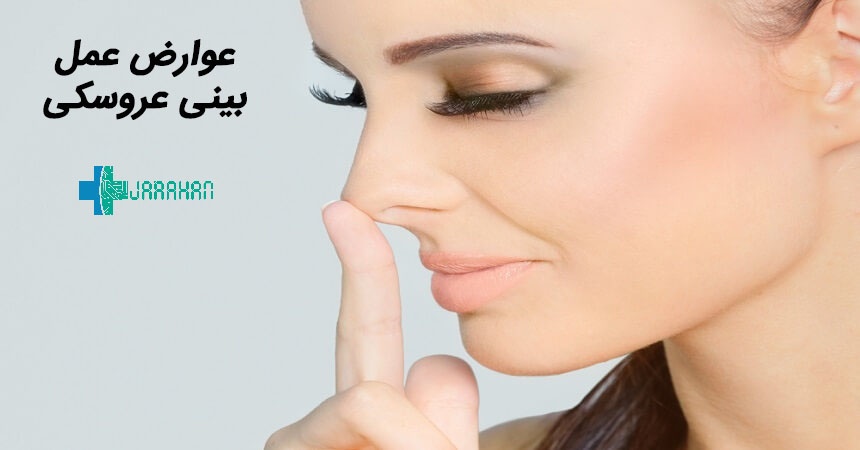 عوارض عمل بینی عروسکی