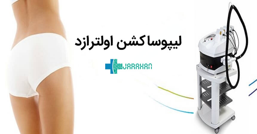 لیپوساکشن اولترازد