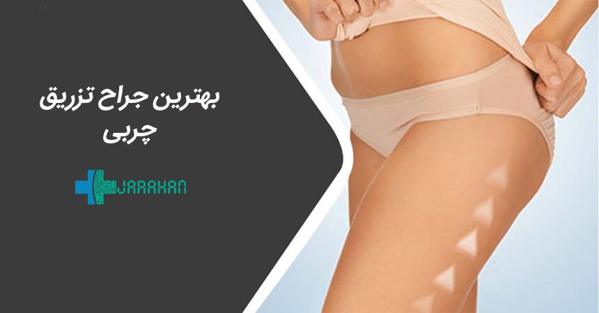 بهترین دکتر جراح تزریق چربی در تهران چه ویژگی هایی دارد؟