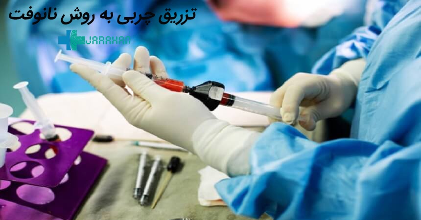 تزریق چربی به روش نانوفت چیست و چه مزایایی دارد؟