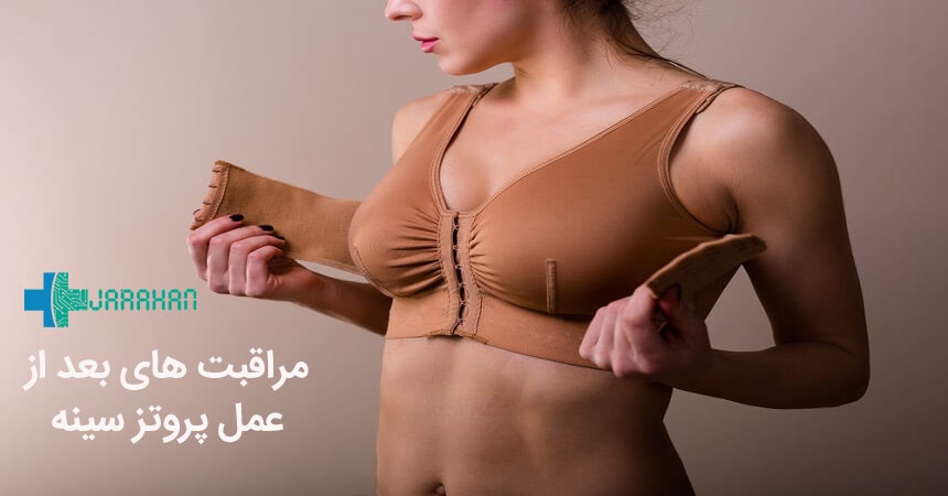 مراقبت های بعد از جراحی پروتز سینه